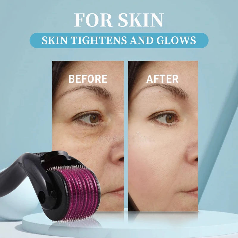 Microneedle-Style Derma Roller – 0.2–0.3 mm Options