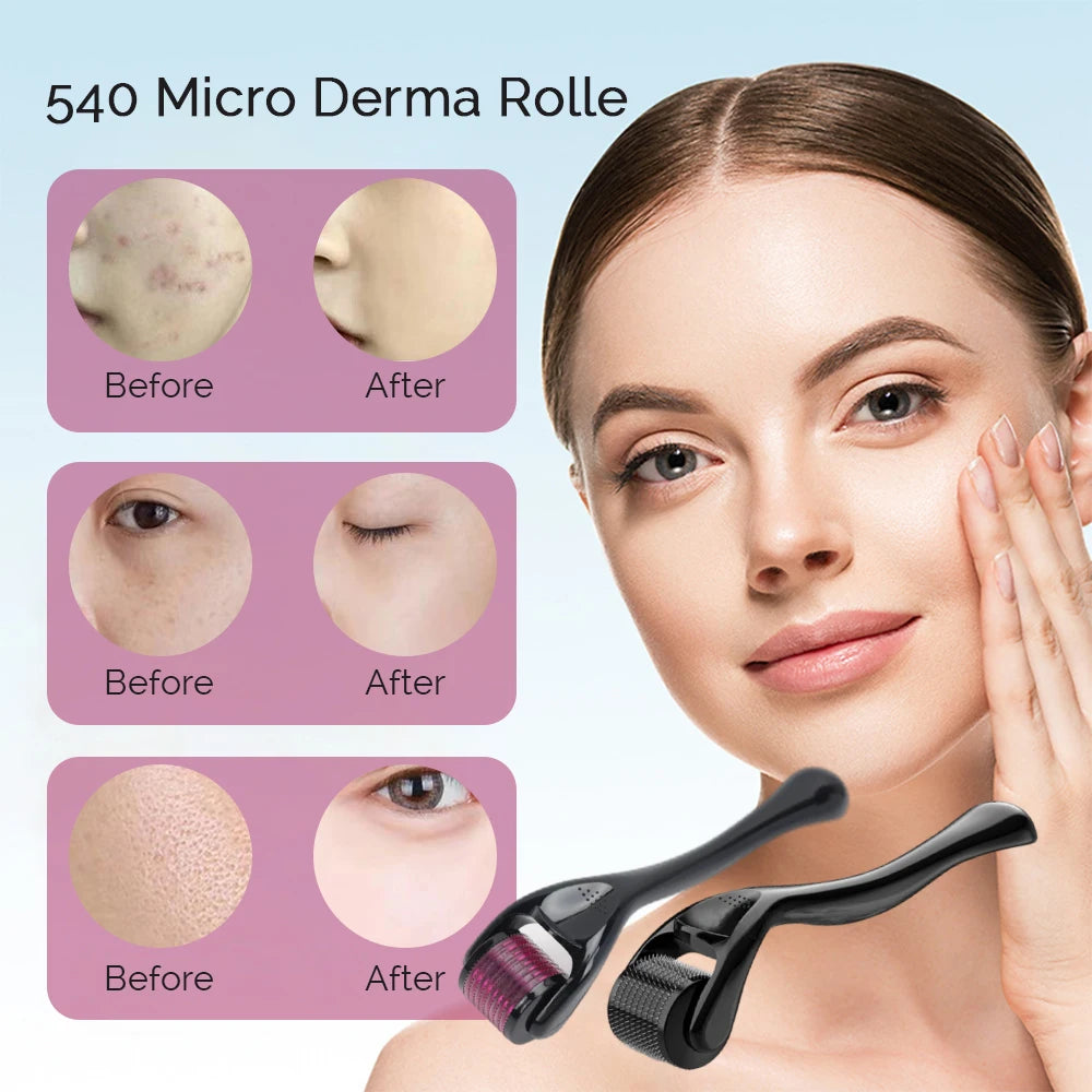 Fine-Needle Derma Roller – Up to 0.25 mm